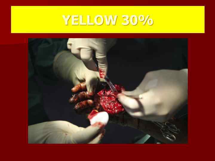 YELLOW 30% 