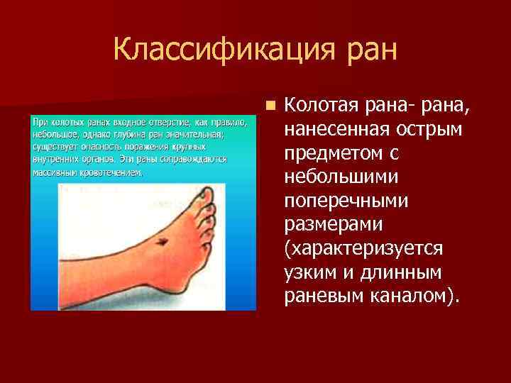 Классификация ран n Колотая рана- рана, нанесенная острым предметом с небольшими поперечными размерами (характеризуется