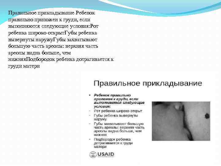 Правильное прикладывание Ребенок правильно приложен к груди, если выполняются следующие условия: Рот ребенка широко