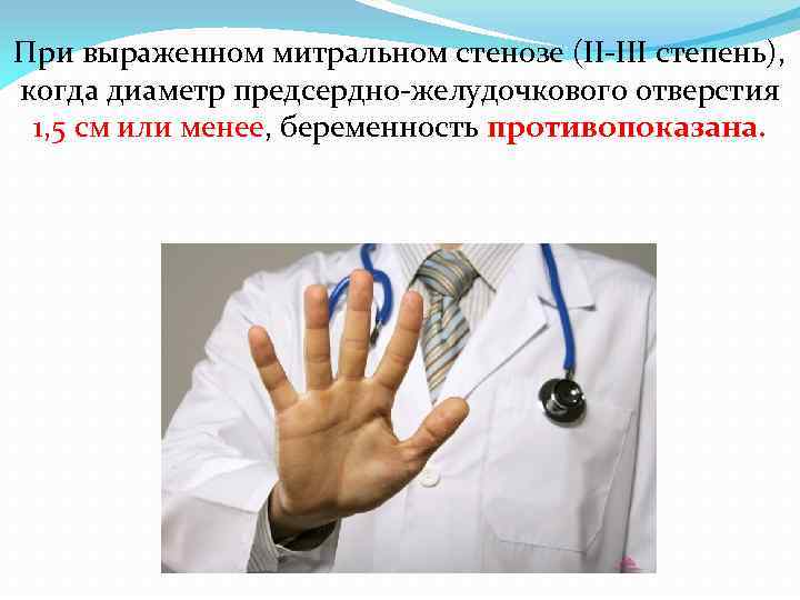 При выраженном митральном стенозе (II-III степень), когда диаметр предсердно-желудочкового отверстия 1, 5 см или