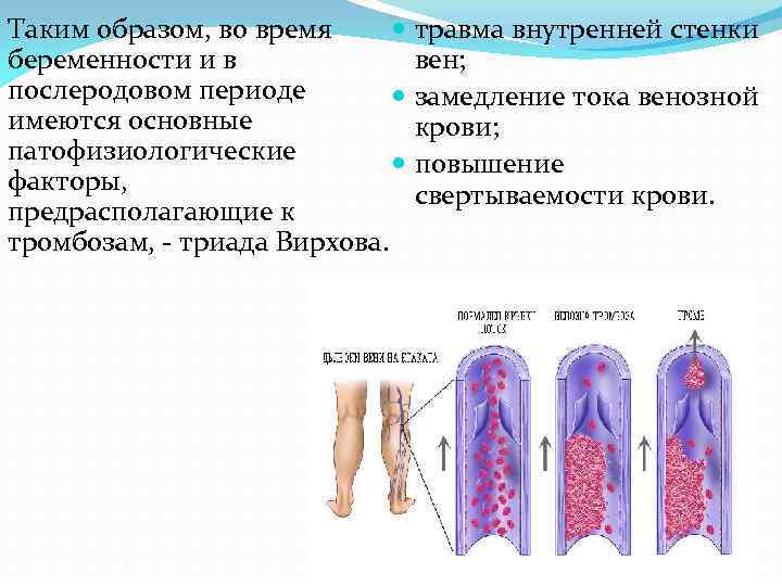 Таким образом, во время травма внутренней стенки беременности и в вен; послеродовом периоде замедление
