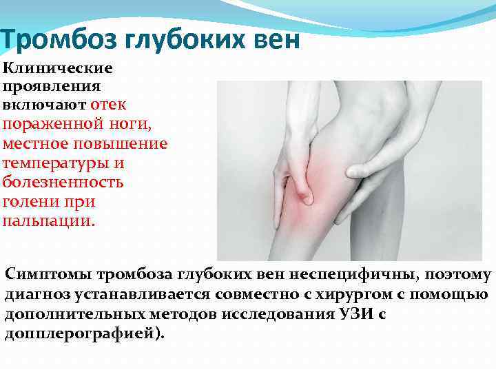 Тромбоз глубоких вен Клинические проявления включают отек пораженной ноги, местное повышение температуры и болезненность