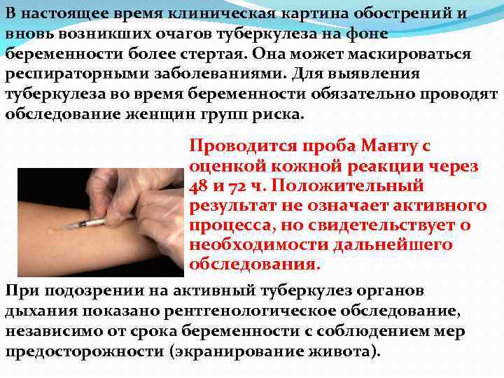 В настоящее время клиническая картина обострений и вновь возникших очагов туберкулеза на фоне беременности