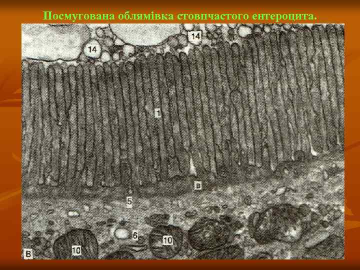 Посмугована облямівка стовпчастого ентероцита. 