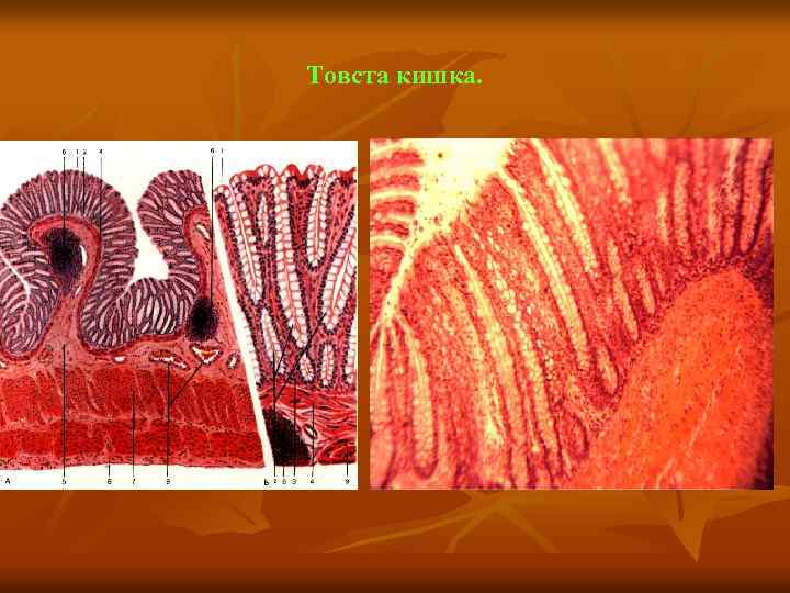 Товста кишка. 