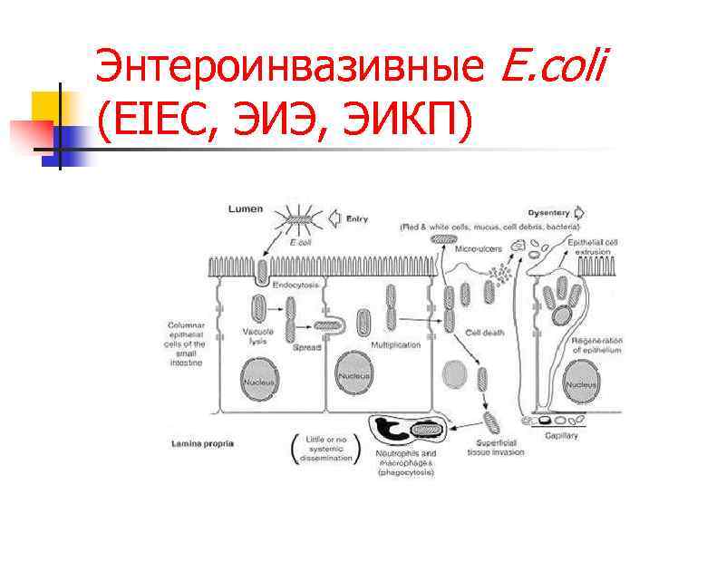 Схема патогенеза эшерихиоза