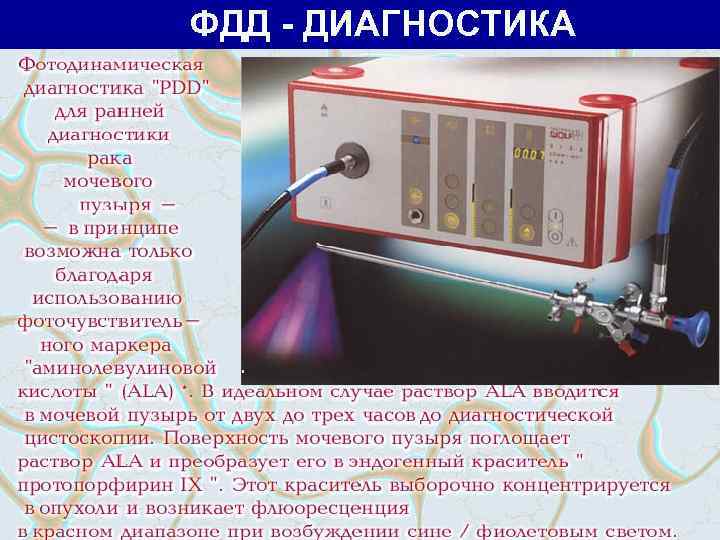 ФДД - ДИАГНОСТИКА 