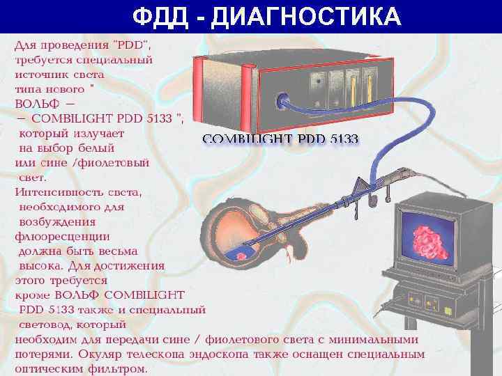 ФДД - ДИАГНОСТИКА 