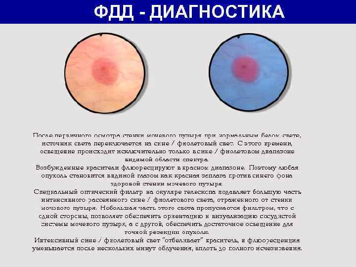 ФДД - ДИАГНОСТИКА 