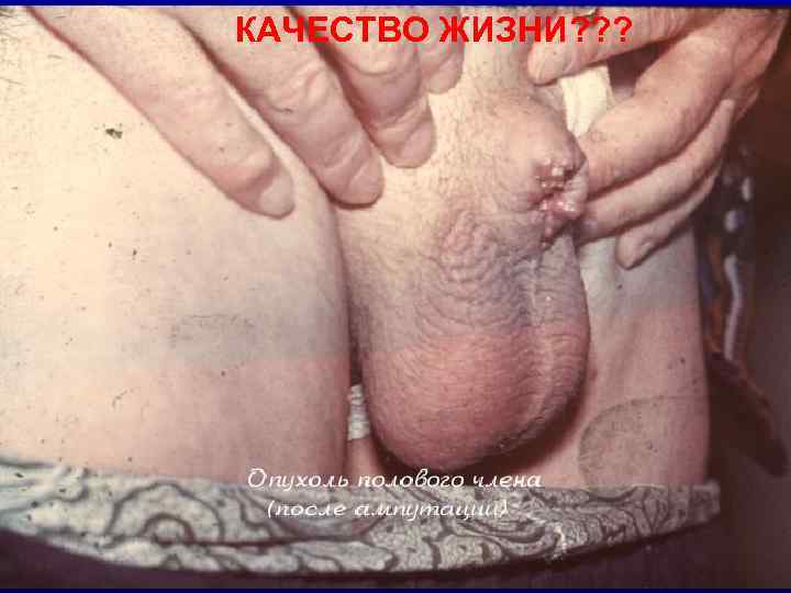 КАЧЕСТВО ЖИЗНИ? ? ? 