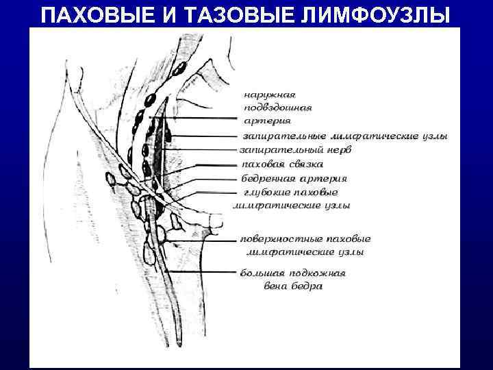 ПАХОВЫЕ И ТАЗОВЫЕ ЛИМФОУЗЛЫ 