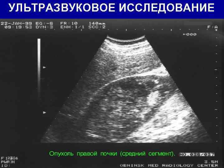 УЛЬТРАЗВУКОВОЕ ИССЛЕДОВАНИЕ 