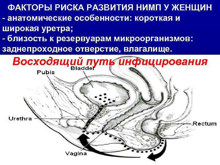 ФАКТОРЫ РИСКА РАЗВИТИЯ НИМП У ЖЕНЩИН - анатомические особенности: короткая и широкая уретра; -