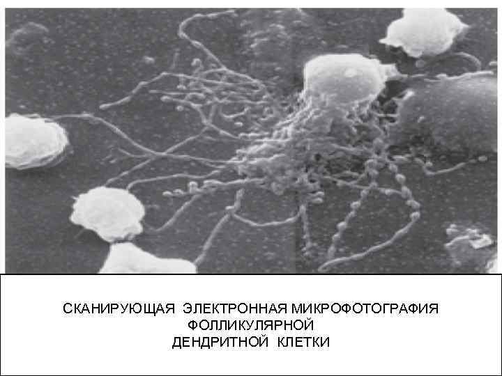 СКАНИРУЮЩАЯ ЭЛЕКТРОННАЯ МИКРОФОТОГРАФИЯ ФОЛЛИКУЛЯРНОЙ ДЕНДРИТНОЙ КЛЕТКИ 