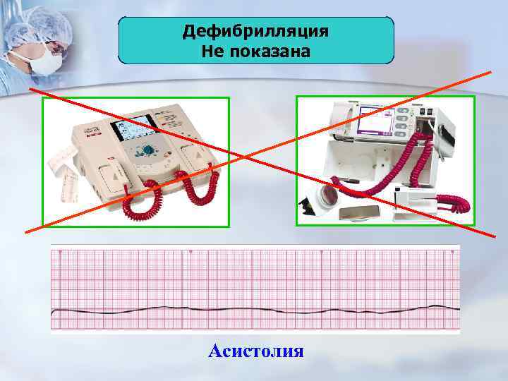 Дефибрилляция Не показана Асистолия 