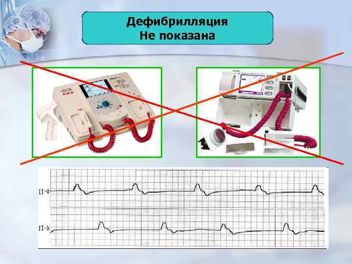 Дефибрилляция Не показана 