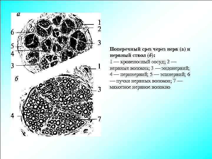 Поперечный срез через нерв (а) и нервный ствол (б): 1 — кровеносный сосуд; 2
