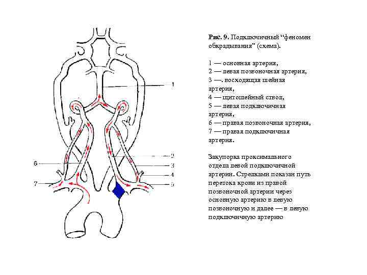 Ветви подключичной артерии схема