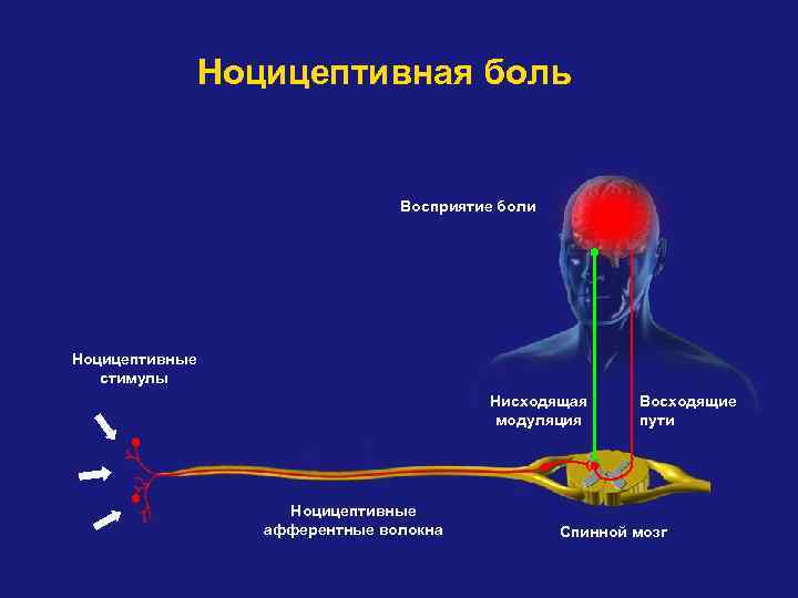 Ноцицептивная боль Восприятие боли Ноцицептивные стимулы Нисходящая модуляция Ноцицептивные афферентные волокна Восходящие пути Спинной