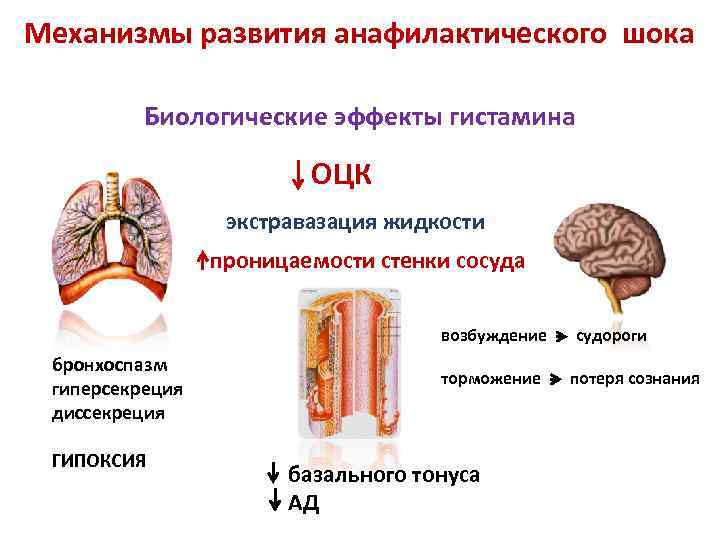 Механизмы развития анафилактического шока Биологические эффекты гистамина ОЦК экстравазация жидкости проницаемости стенки сосуда возбуждение