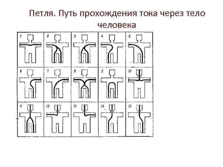 Опасный путь протекания электротока через человека