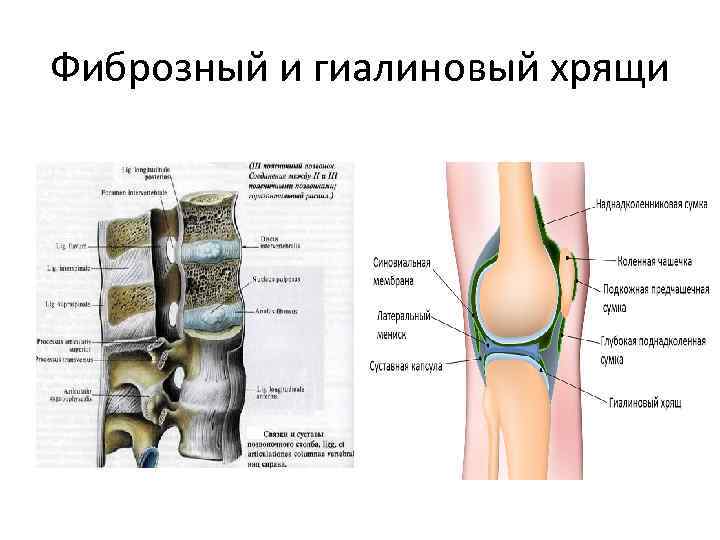 Фиброзные изменения тканей. Строение сустава гиалиновый хрящ. Гиалиновый хрящ строение кости. Строение сустава гиалиновый хрящ и кость. Фиброзный хрящ.