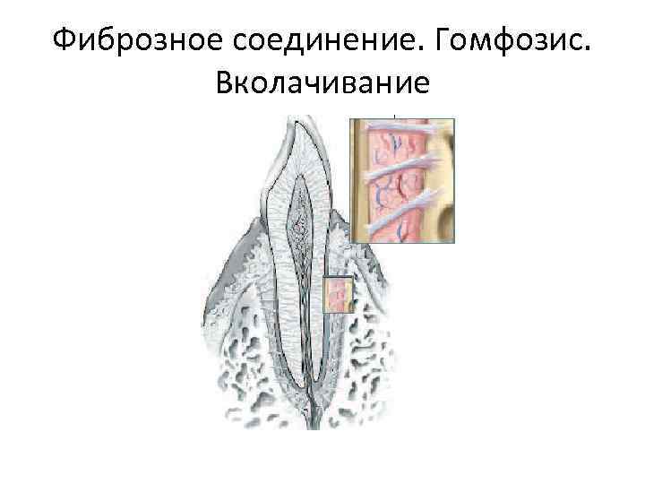 Фиброзное соединение. Гомфозис. Вколачивание 