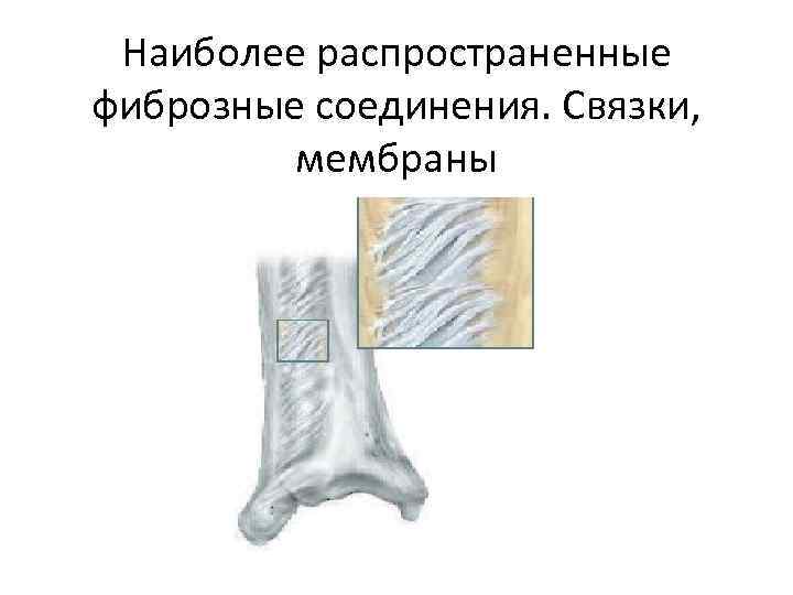 Наиболее распространенные фиброзные соединения. Связки, мембраны 