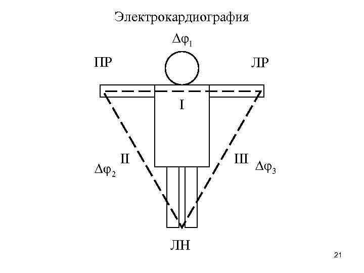 Электрокардиография ПР ЛР I II III ЛН 21 