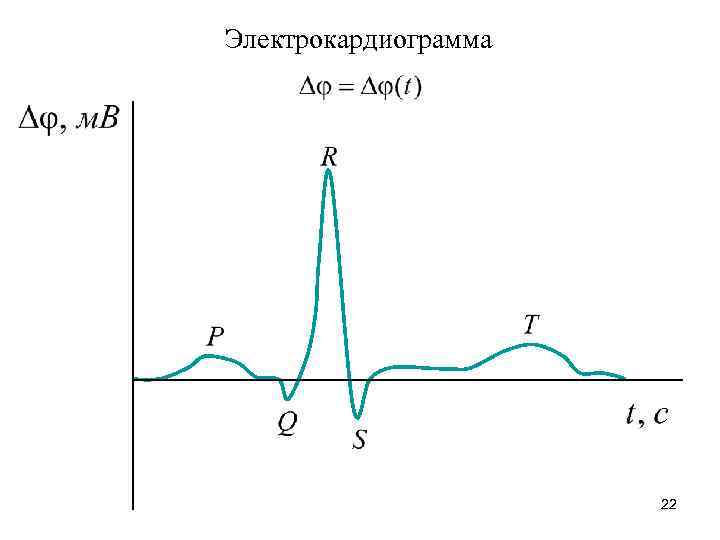 Электрокардиограмма 22 