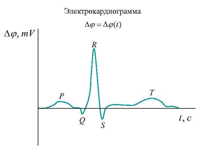 Электрокардиограмма 