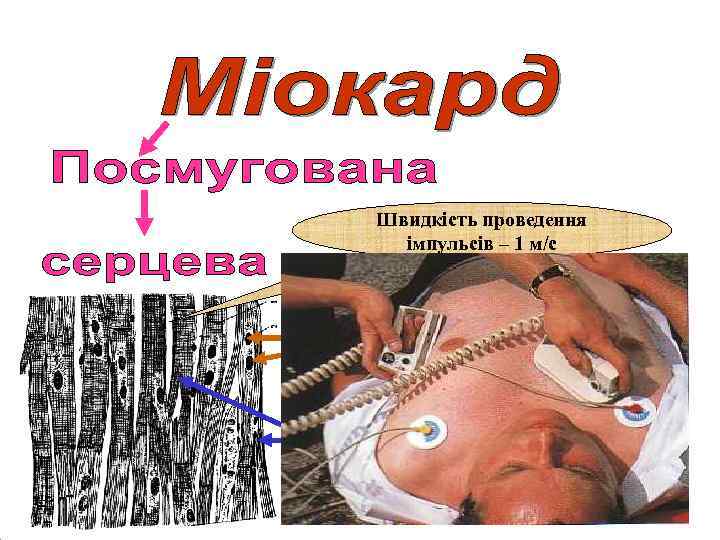 Швидкість проведення імпульсів – 1 м/с 