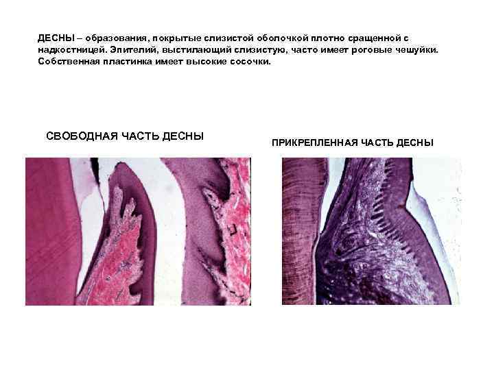 ДЕСНЫ – образования, покрытые слизистой оболочкой плотно сращенной с надкостницей. Эпителий, выстилающий слизистую, часто