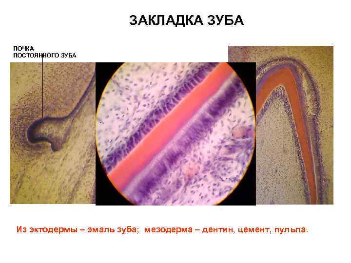 ЗАКЛАДКА ЗУБА ПОЧКА ПОСТОЯННОГО ЗУБА ЭНАМЕЛОБЛАСТЫ ЭМАЛЬ ДЕНТИН ОДОНТОБЛАСТЫ ПУЛЬПА Из эктодермы – эмаль