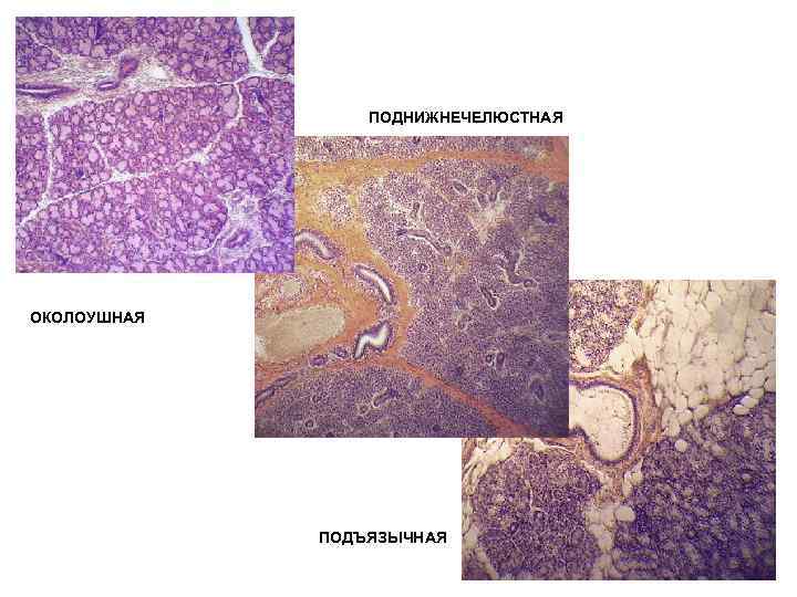 ПОДНИЖНЕЧЕЛЮСТНАЯ ОКОЛОУШНАЯ ПОДЪЯЗЫЧНАЯ 