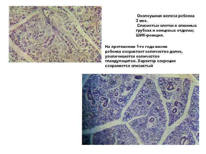 Околоушная железа ребенка 3 мес. Слизистые клетки в слюнных трубках и концевых отделах; ШИК-реакция.