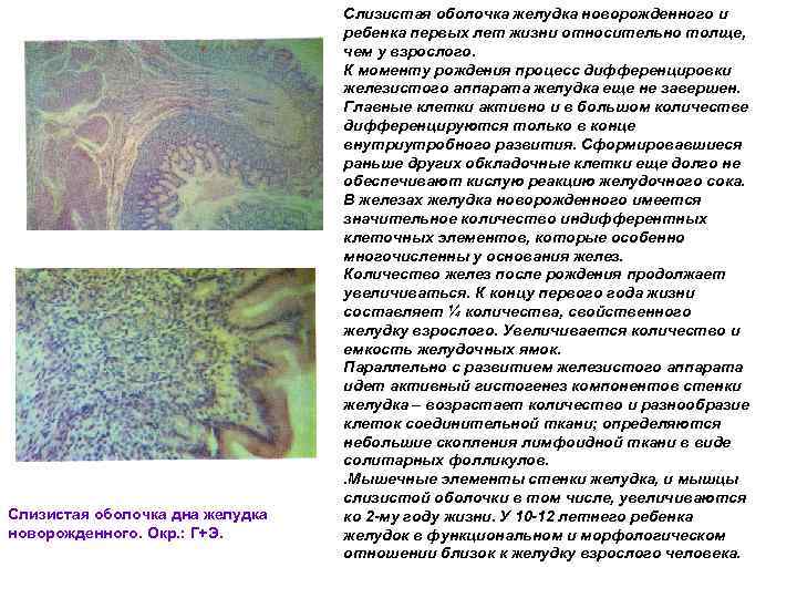 Слизистая оболочка дна желудка новорожденного. Окр. : Г+Э. Слизистая оболочка желудка новорожденного и ребенка
