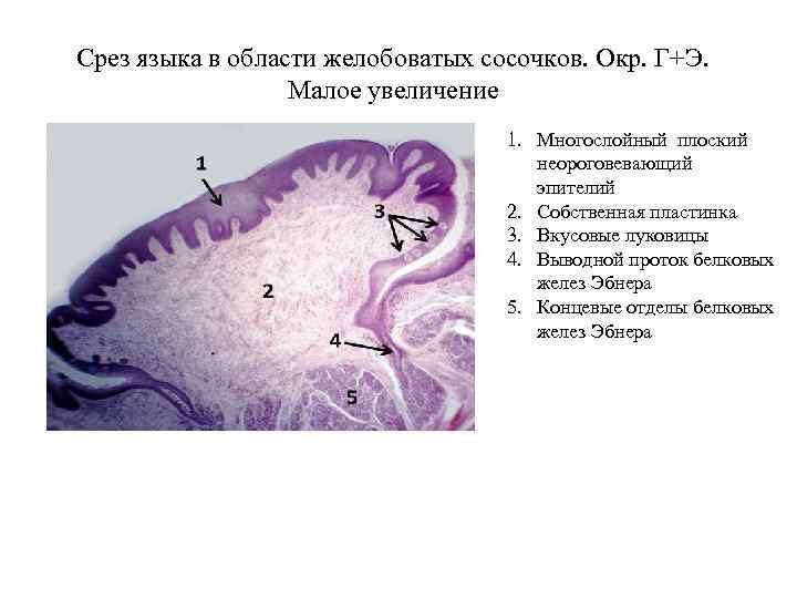 Срез языка в области желобоватых сосочков. Окр. Г+Э. Малое увеличение 1. Многослойный плоский неороговевающий