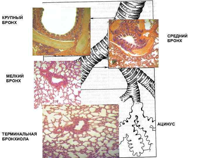 КРУПНЫЙ БРОНХ СРЕДНИЙ БРОНХ МЕЛКИЙ БРОНХ АЦИНУС ТЕРМИНАЛЬНАЯ БРОНХИОЛА 