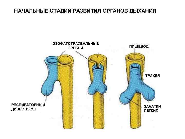 Дивертикул стенки трахеи