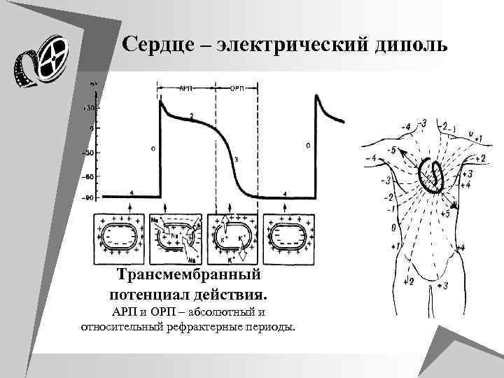 Сердце – электрический диполь Трансмембранный потенциал действия. АРП и ОРП – абсолютный и относительный