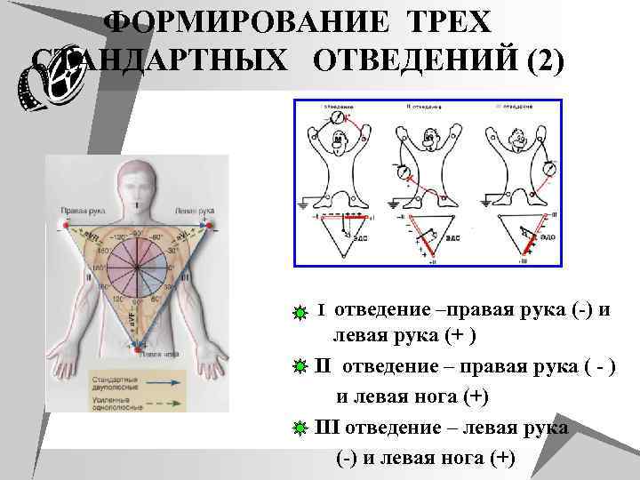 ФОРМИРОВАНИЕ ТРЕХ СТАНДАРТНЫХ ОТВЕДЕНИЙ (2) I отведение –правая рука (-) и левая рука (+