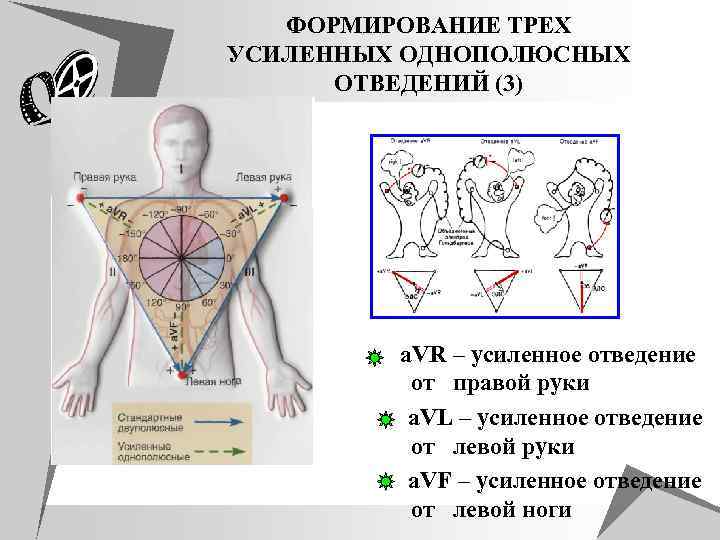 Правые отведения. Усиленные отведения на треугольнике Эйнтховена. Усиленные однополюсные отведения ЭКГ. Треугольник Эйнтховена стандартные отведения. Стандартные и усиленные отведения ЭКГ.