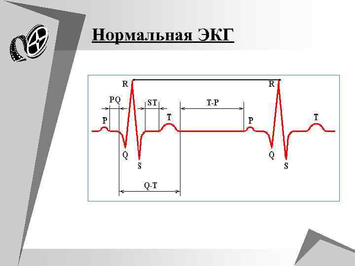 Схема экг. ЭКГ норма пропедевтика. Нормальная ЭКГ пропедевтика внутренних болезней. ЭКГ В норме пропедевтика внутренних болезней. Расшифровка ЭКГ пропедевтика.