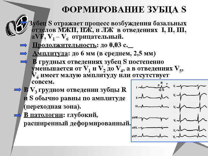 ФОРМИРОВАНИЕ ЗУБЦА S Зубец S отражает процесс возбуждения базальных отделов МЖП, ПЖ, и ЛЖ