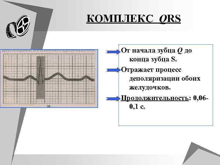 КОМПЛЕКС QRS От начала зубца Q до конца зубца S. Отражает процесс деполяризации обоих