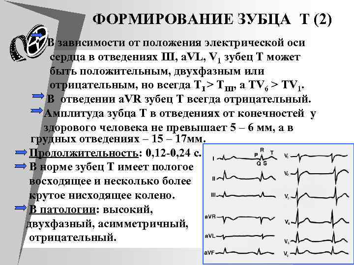 ФOРМИРOВАНИЕ ЗУБЦА T (2) В зависимости от положения электрической оси сердца в отведениях III,