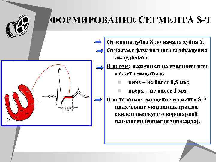 В норме находится в. Сегмент St в норме. Формирование зубца s. Зубец s норма. Формирование сегмента s.