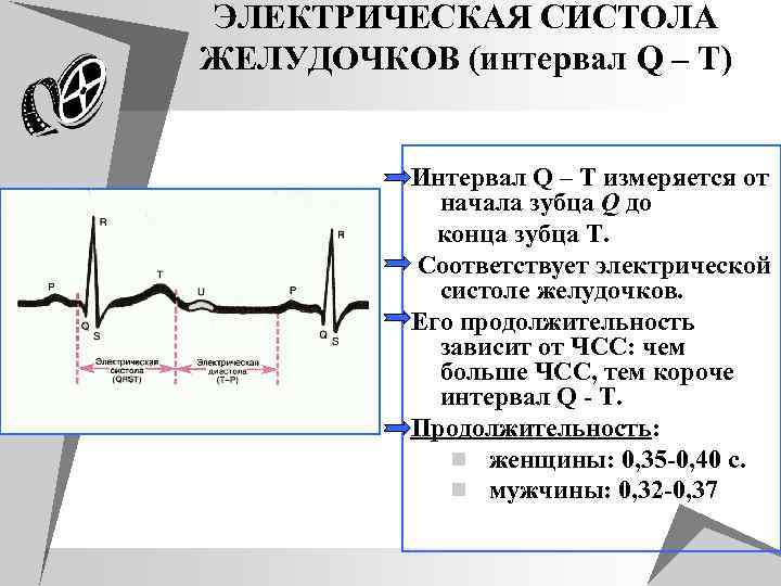 ЭЛЕКТРИЧЕСКАЯ СИСТОЛА ЖЕЛУДОЧКОВ (интервал Q – T) Интервал Q – T измеряется от начала