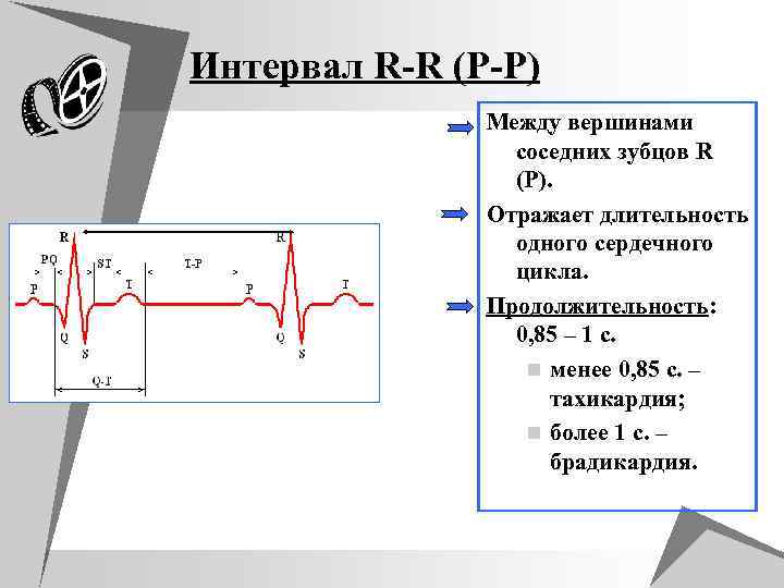 Интервал R-R (P-P) Между вершинами соседних зубцов R (P). Отражает длительность одного сердечного цикла.